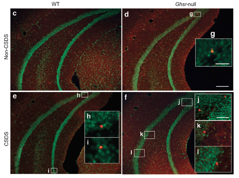 Ghrelin increases the rewarding value of high-fat diet in an orexin-dependent manner