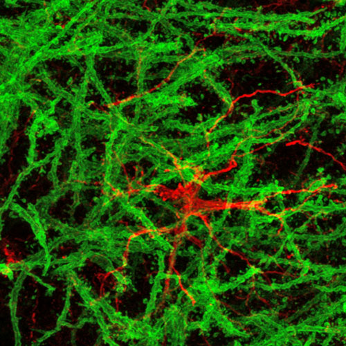 gfap-and-chr2-neuron_Airyscan-mouse-brain
