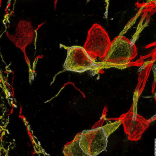 mc4rchr2yfp-neuron-mouse-brain